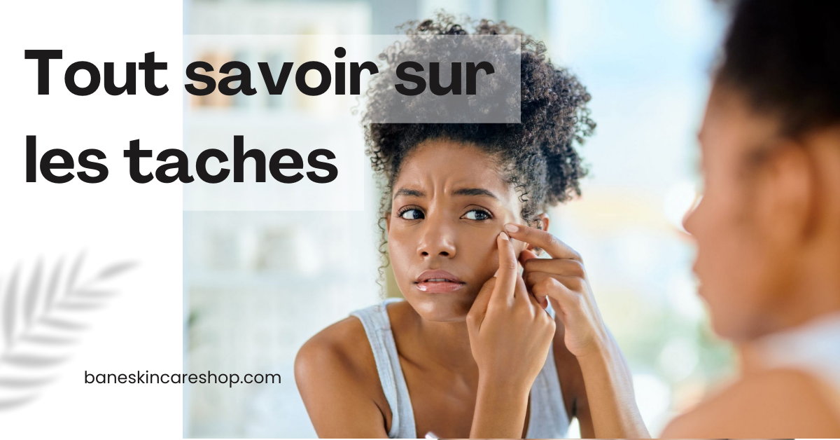 Tout savoir sur les taches sur le visage | BaneskincareShop | Soins naturels - cosmetiques coreenes