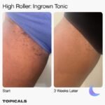 TOPICALS High Roller – Sérum Tonique Anti-Poils Incarnés – Image 3