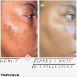 TOPICALS Faded Crème / sérum anti-tâches & hyperpigmentation: – Image 4