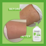 AmLactin – Lait Exfoliant Hydratant à l’Acide Lactique 12% – 225 g – Image 8