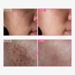 Tosowoong – Crème Éclaircissante & Anti-Âge à 7% d’Arbutine +tranexamique 4%cream 50g – Image 2