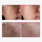 Tosowoong – Crème Éclaircissante & Anti-Âge à 7% d’Arbutine +tranexamique 4%cream 50g – Image 2