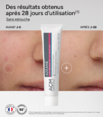 ACM Azéane 15,5 % – Crème à l’Acide Azélaïque:
Soin anti-imperfections, taches & rougeurs – 30 ml – Image 4
